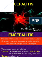 ENCEFALITIS