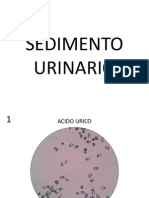 SEDIMENTO URINARIO