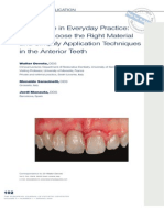Composite in Everyday Practice - How To Choose The Right Material and Simplify Application Techniques in The Anterior Teeth