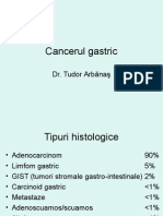 4.Cancerul Gastric