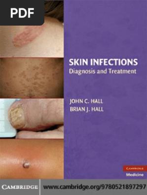 Skin Infectious Elisa Infection