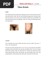 Download Tinea Kruris by einjhi SN27161650 doc pdf