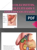 Colecistitiscolelitiasisycoledocolitiasis 1