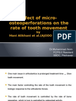 Effect of Micro-Osteoperforations On The Rate of Tooth Movement