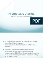 Miomatosis Uterina
