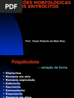 Alterações Morfológicas dos Eritrócitos