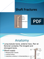 Femur Shaft Fractures