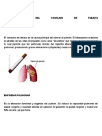 CONSECUENCIAS DEL CONSUMO DE TABACO.docx