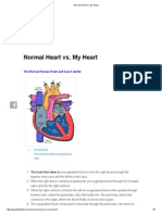 Normal Heart Vs