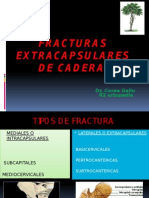 Fracturas Extracapsulares de Cadera COREA