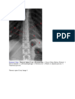 Thoracic Spine X-ray AP View Anatomy