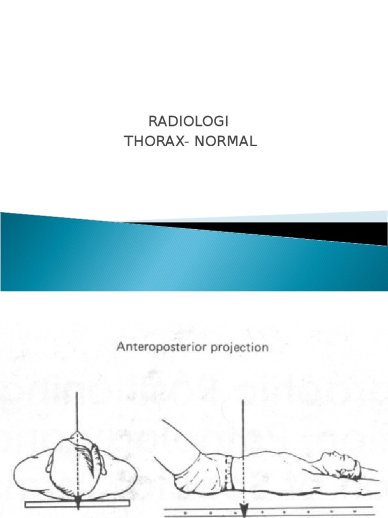 Interpretasi Radiologi Thorax Normal | PDF