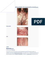 Infecciones y Enfermedades de Transmisión Sexual