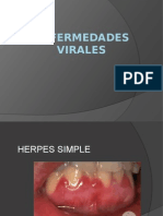 Enfermedades Virales