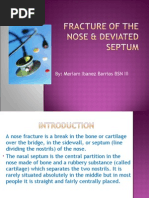 Download nose fracture and deviated septum by mimi2188 SN27244131 doc pdf