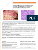 A Case Report Documenting A Rare Diagnosis of A Plasmablastic Lymphoma