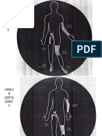 Deformitas Muskuloskeletal Dalam Tinjauan Bedah