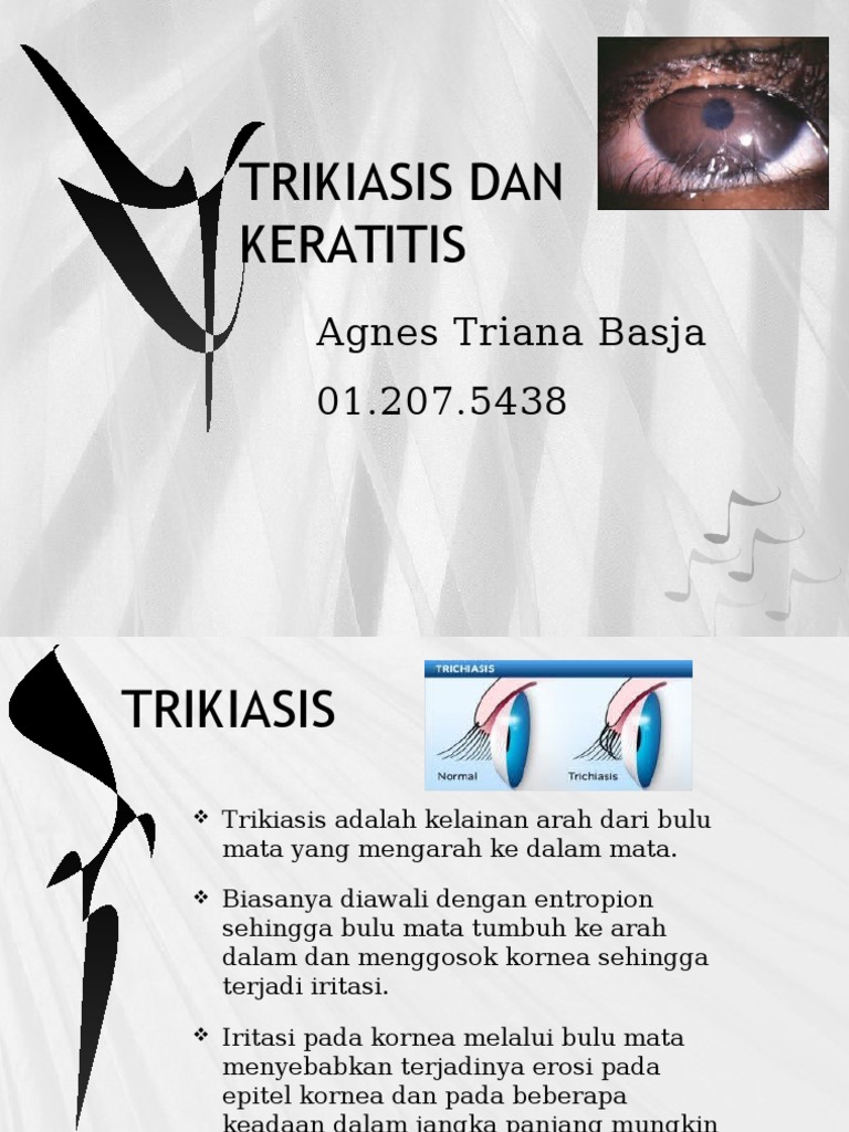 Trikiasis dan Keratitis: Diagnosis & Terapi | PDF | Kesehatan Holistik ...