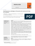 Sarcoma de Ewing