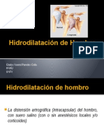 Hidrodilatación de Hombro 