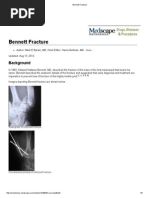 Bennett Fracture