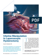 Laparascopic Uterine Elevator