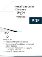 Peripheral Vascular Disease (PVD) : By: Megan Moore Jack Arnold