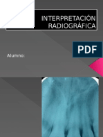 INTERPRETACIÓN RADIOGRÁFICA