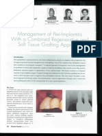 Management of Peri-Implantitis Using A Combined Regenerative and Soft Tissue Grafting Approach Nwachukwu OG, Hosseini H, Cholakis A