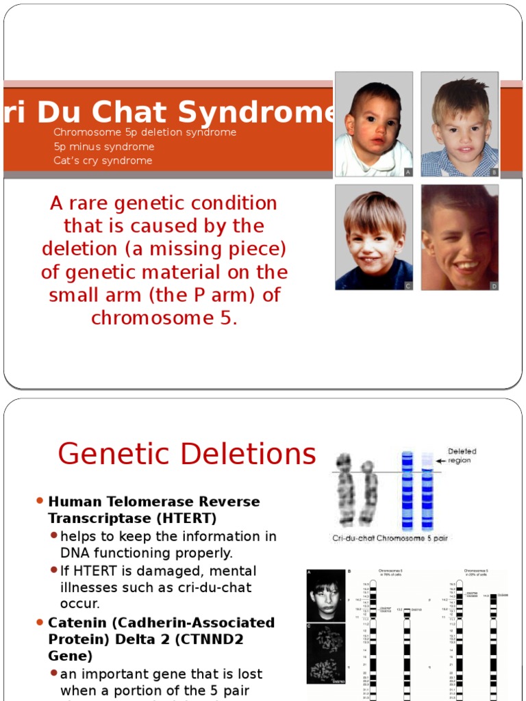 Cri Du Chat Syndrome