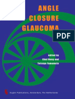 Angle Closure Glaucoma