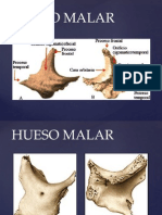 Hueso Malar