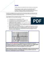 El Electrocardiograma