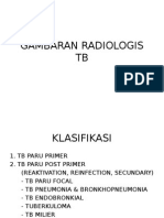 Gambaran Radiologis Tb