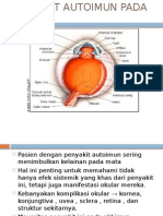 Penyakit Autoimun Pada Mata