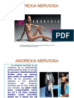 ANOREXIA.ppt