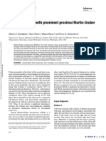 Ulnar Neuropathy With Prominent Proximal Martin-Gruber