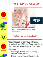 BRAIN ATTACK.ppt