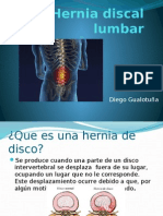 Hernia Discal Lumbar