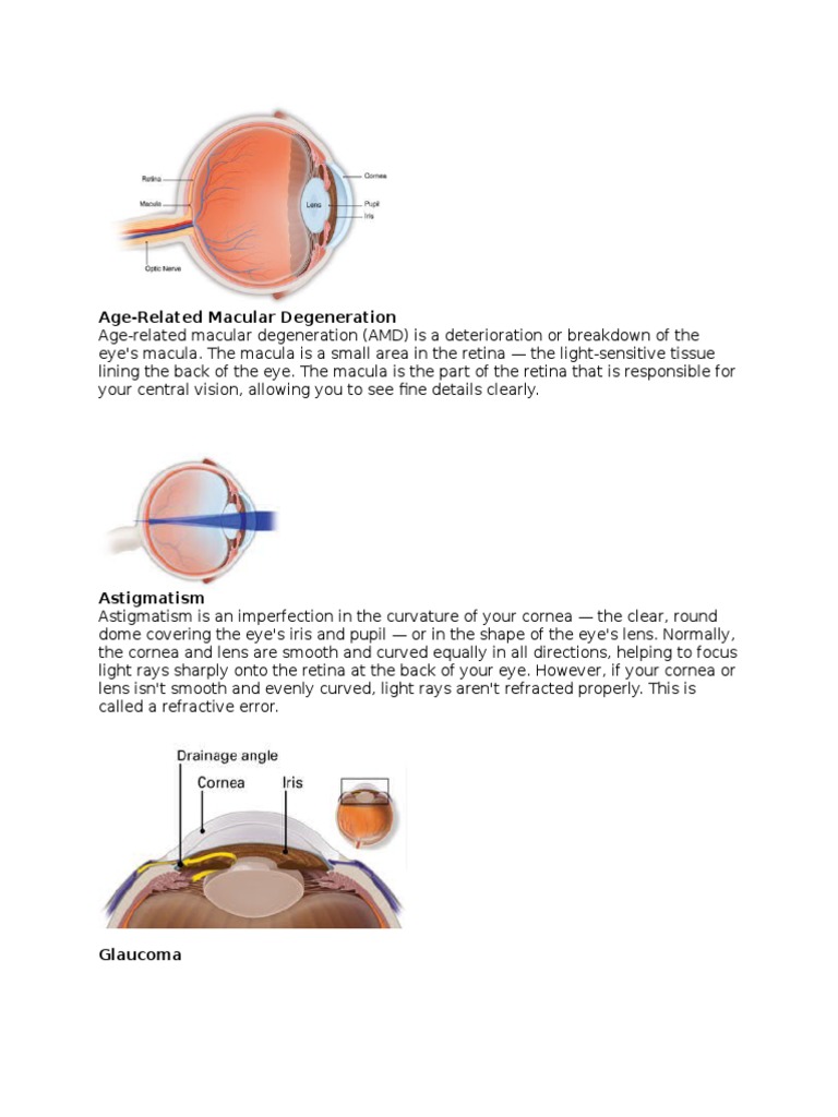 Common Eye Conditions Explained | PDF | Science & Mathematics