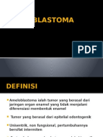 Ameloblastoma