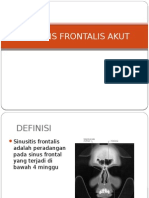 Sinusitis Frontalis Akut