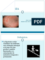 Hipotonia Ocular