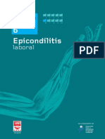 Epicondilitis laboral
