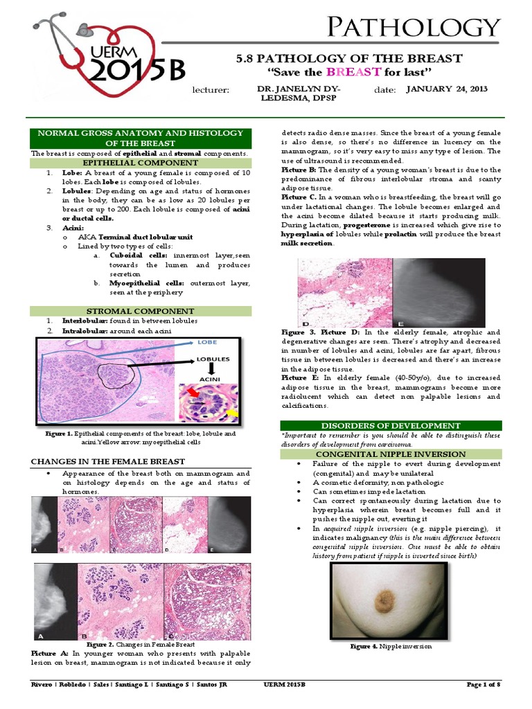 PATHO5 - Pathology of The Breast 2015B PDF | PDF | Metastasis | Breast ...