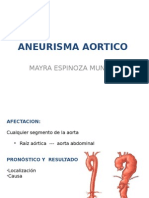 Aneurisma Aortico