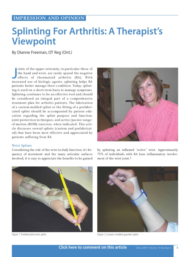 RA Splints | PDF