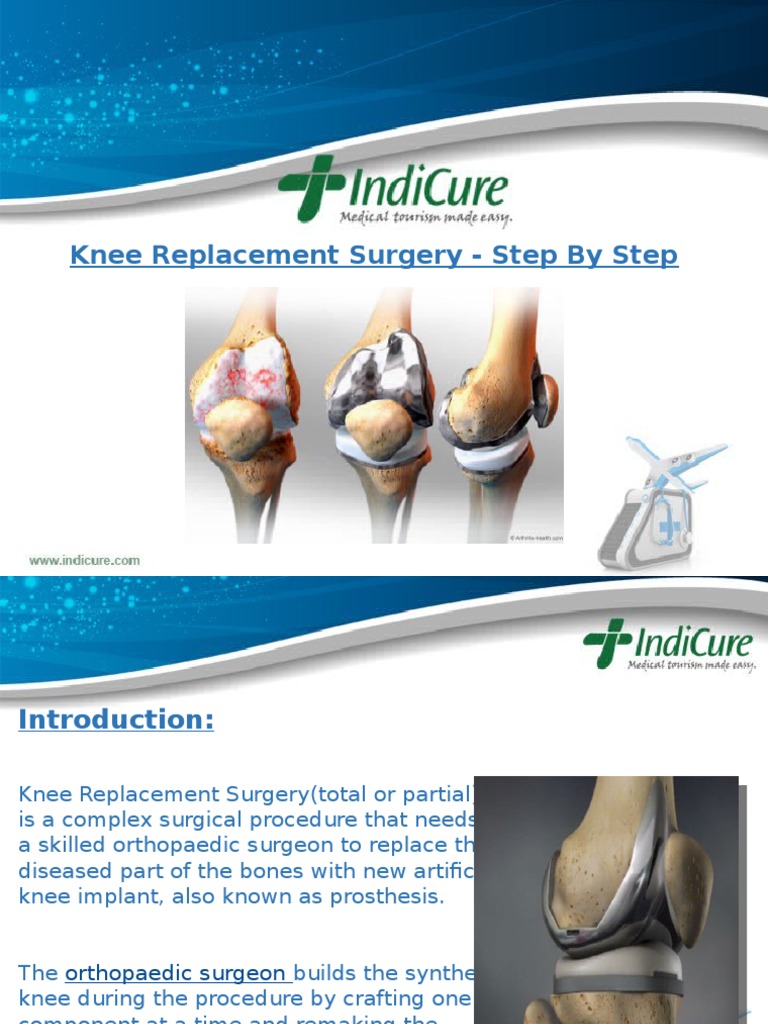 Knee Replacement Surgery in India with IndiCure (StepbyStep) Knee