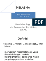 MELASMA