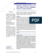 Malignant Mandibular Tumors: Two Case Reports of Rare Mandibular Tumors in A Single Institution